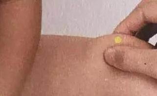 小儿推拿基本手法