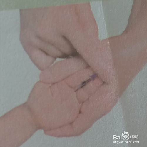 小儿慢性支气管炎的推拿按摩手法