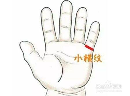 小儿咳嗽推拿按摩手法—风热咳嗽