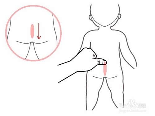 小儿推拿怎么做，小儿推拿的好处与手法介绍
