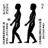 埋线减肥与针灸减肥有什么区别