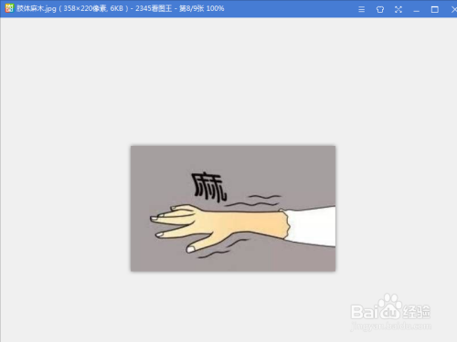 高血压的症状?