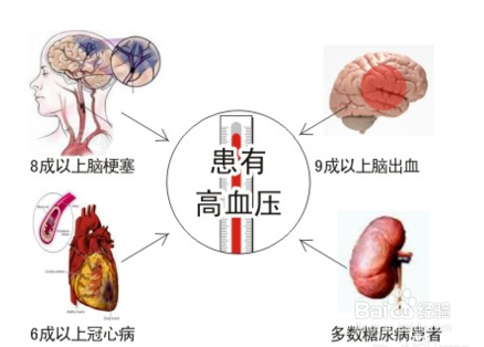 高血压的形成原因如何预防高血压