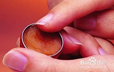 【生活常识】清凉油的妙用