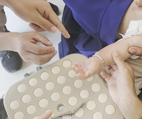不到一岁的女宝遭烫伤，一对银手镯成了救治“拦路虎”