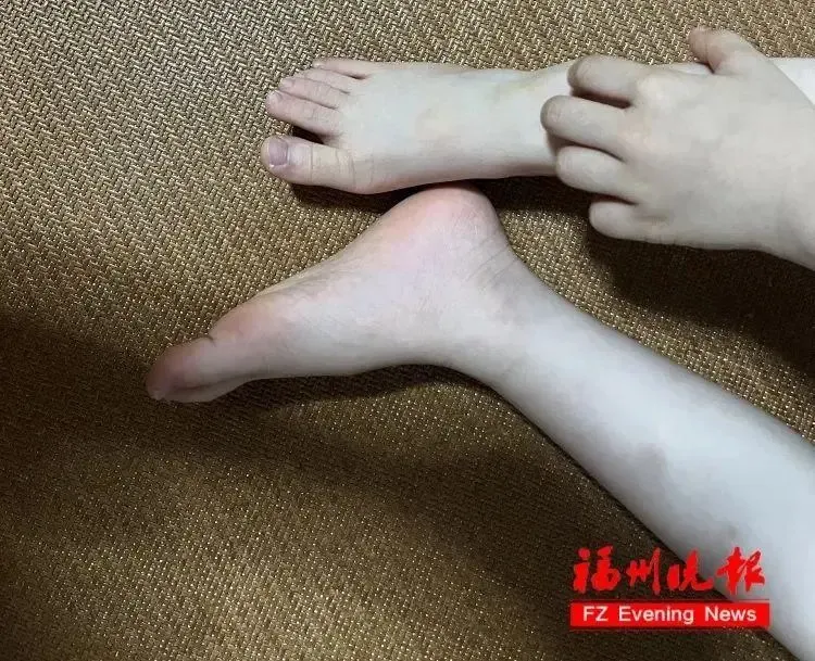 一觉醒来身上密密麻麻全是！天热高发，家家户户都在用！罪魁祸首是它