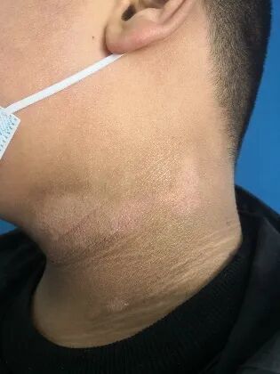 脖子总是黑黑的洗不干净?不是邋遢,可能是身体发出的警报!