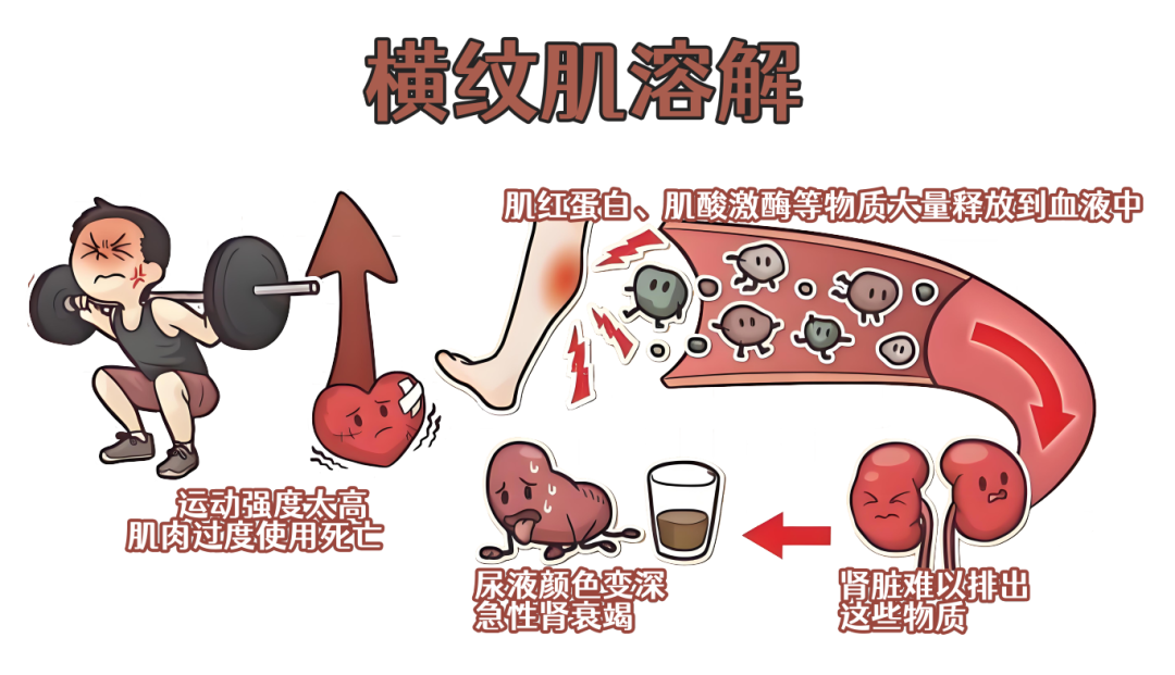 用力过猛！杭州25岁小伙排出“酱油”，送医急救！医生：别硬扛……