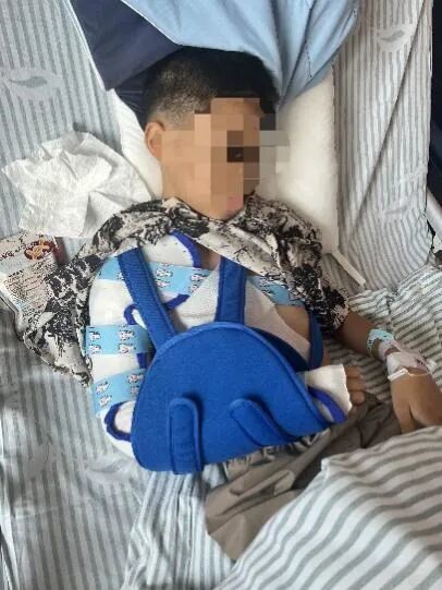 惊魂!10岁男孩遭遇洗衣机“陷阱”,右臂粉碎性骨折!上海医生提醒