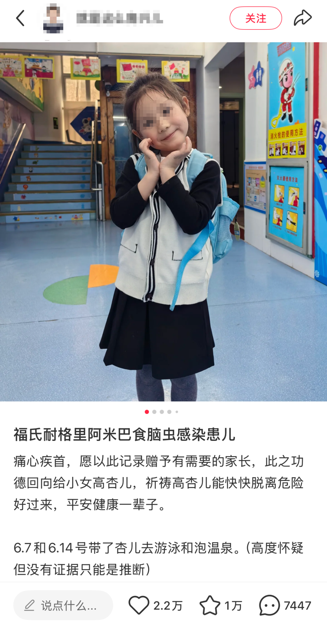 游泳泡温泉后感染！5岁女童昏迷不醒转入ICU，家长称恶化太快！致死率高达98%，医生提醒