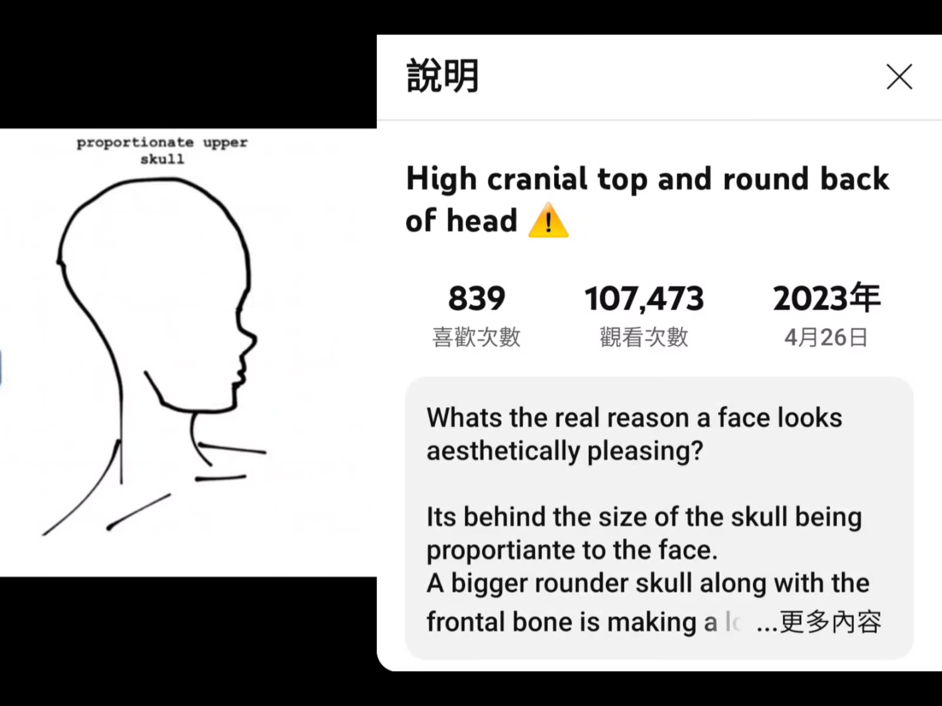 高顱頂 圓後腦勺 skull