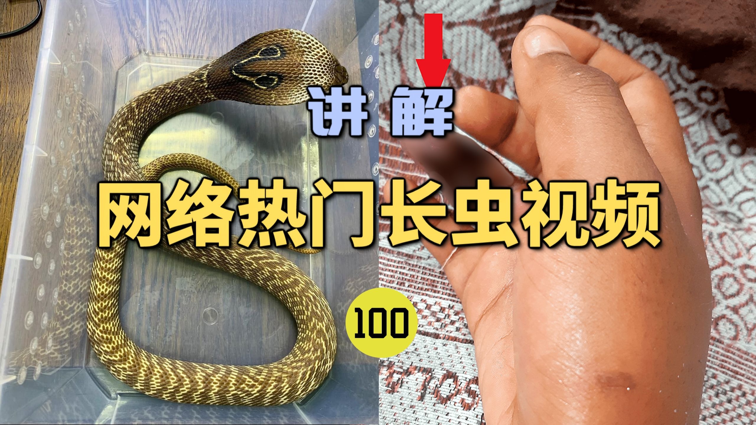 网络热门长虫视频(100)男子在睡觉时被眼镜蛇咬伤10口？第二天
