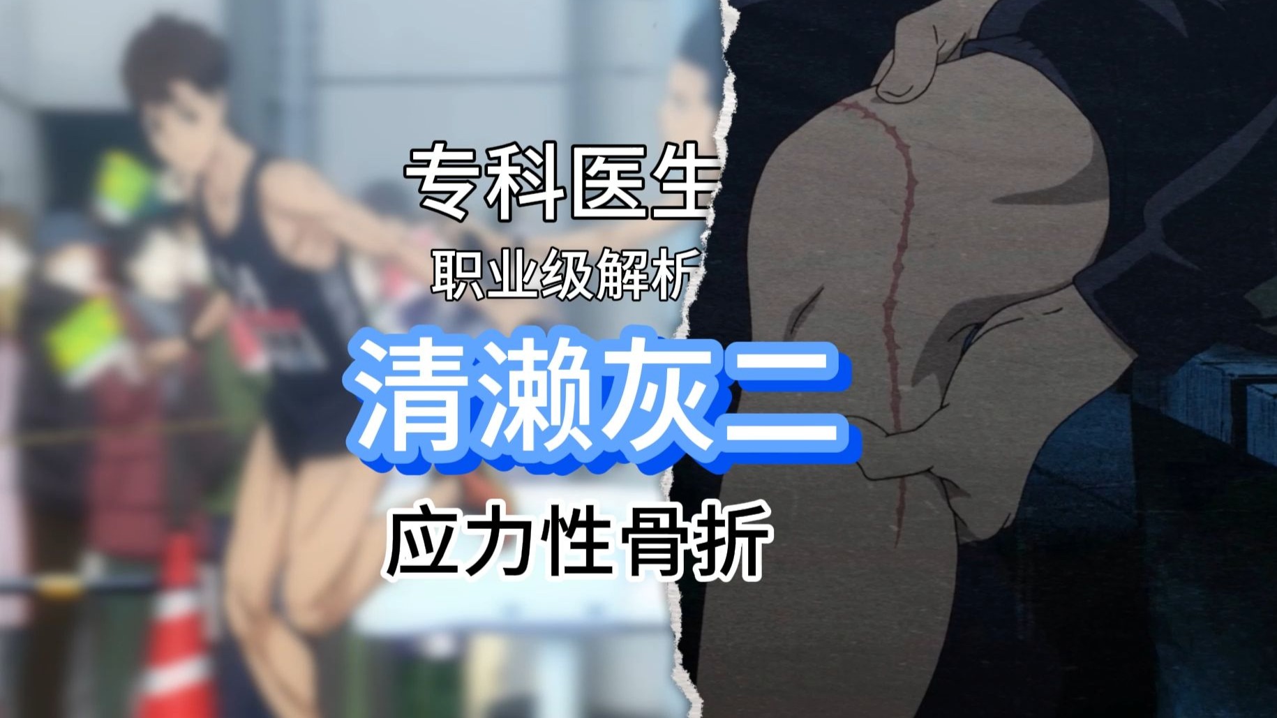 【狗子剧医】阻止灰二强风吹拂的除了骨折，居然还有这种罕见病