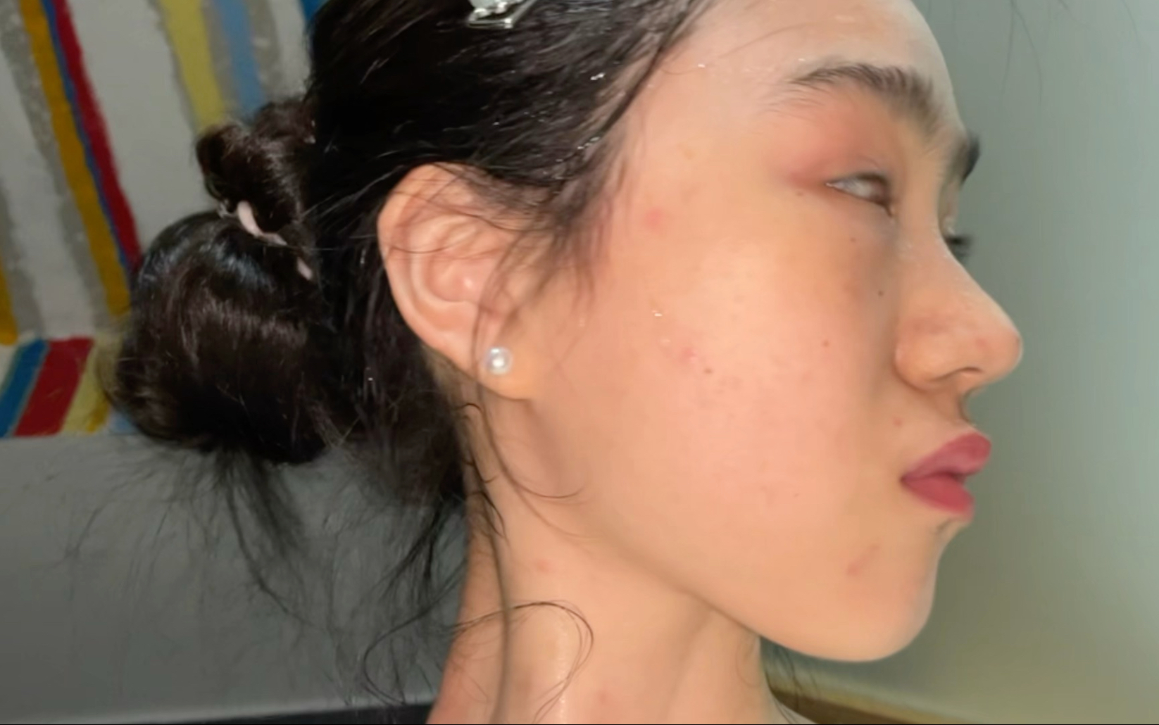 其实还有点痒，但想吃锅包肉了，也想大家了（我怎么会说出这种话）