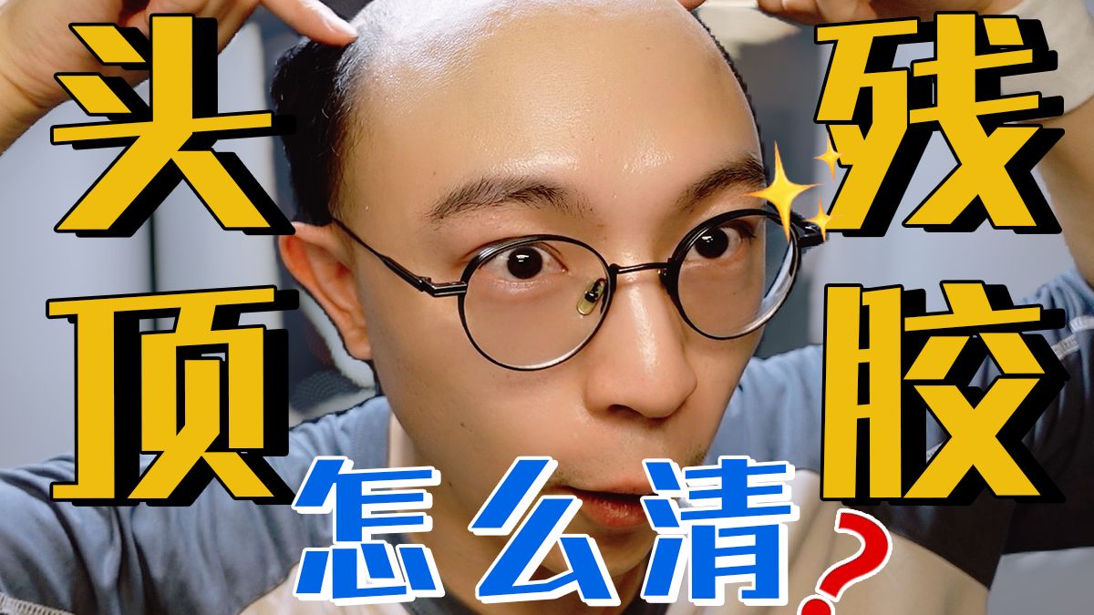 又黏又难清！假发胶片化胶后，头皮如何快速清理？