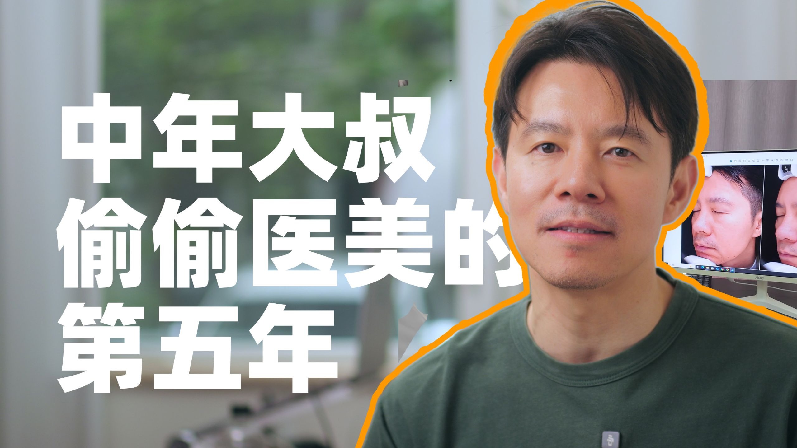 一个项目做了5年 Fotona 4D靠谱吗？