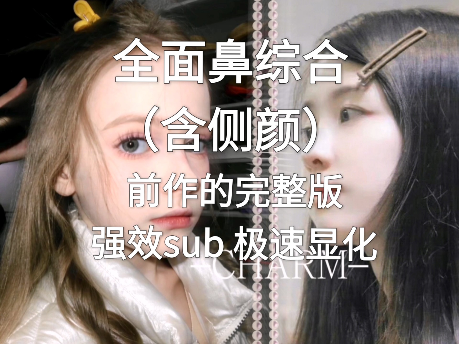 【SUB】完整版鼻综合：盒型鼻➕高鼻梁➕窄鼻翼➕小鼻头➕精致