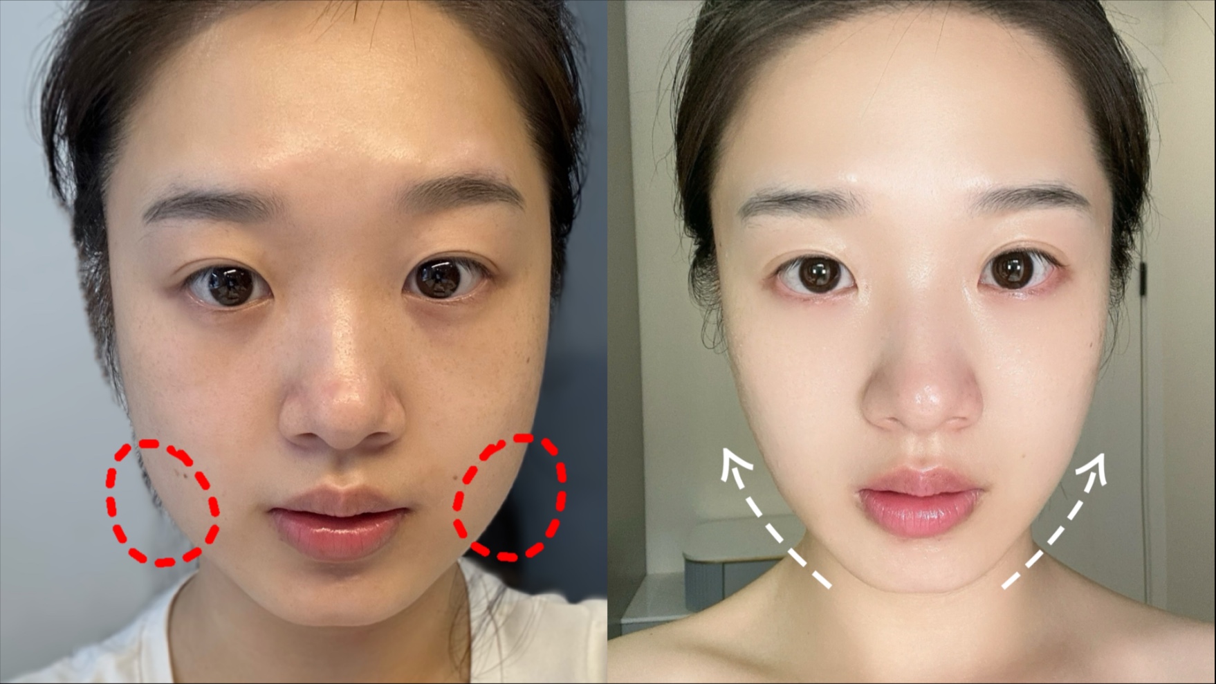 本人认为目前瘦脸最快的运动—邪修版