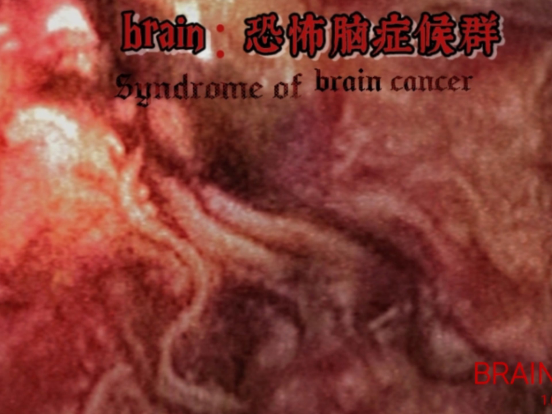 【R18G】抽筋拔骨的圣颂歌——「brain：恐怖脑症候群」Chapter