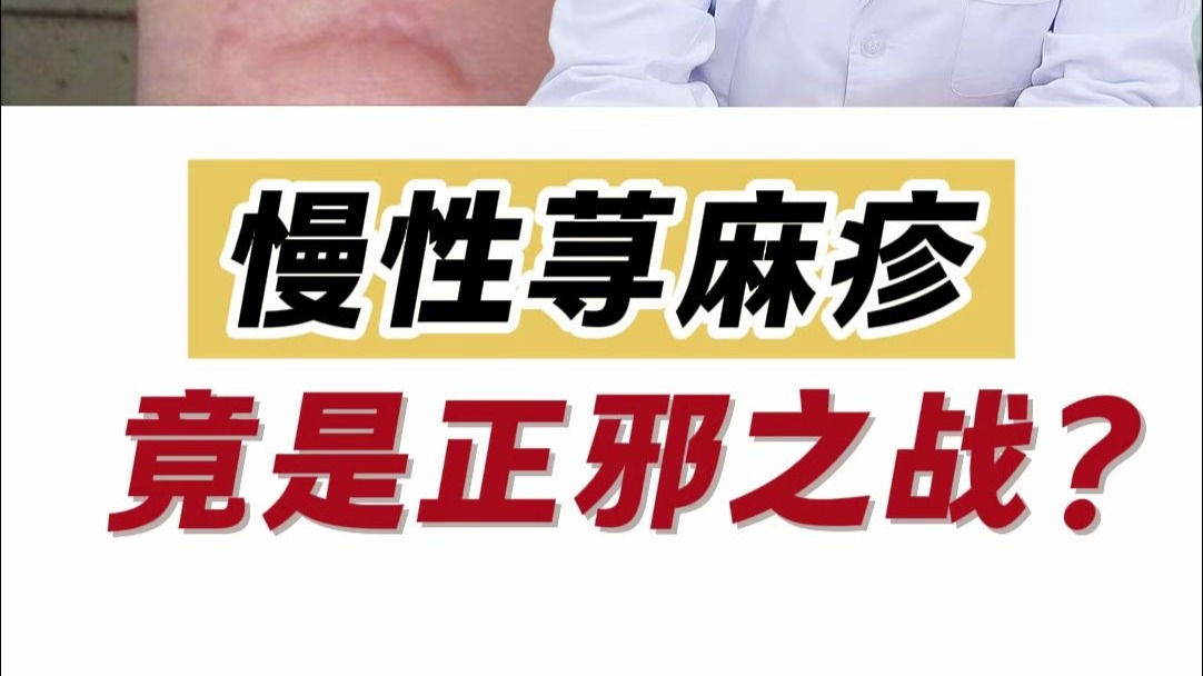 慢性荨麻疹 竟是正邪之战？