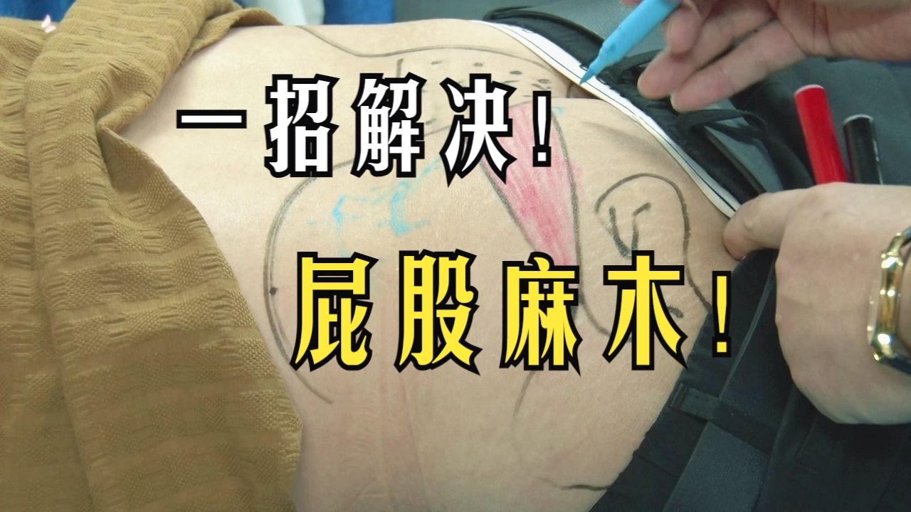 一招柔性正骨教你解决屁股麻木情况