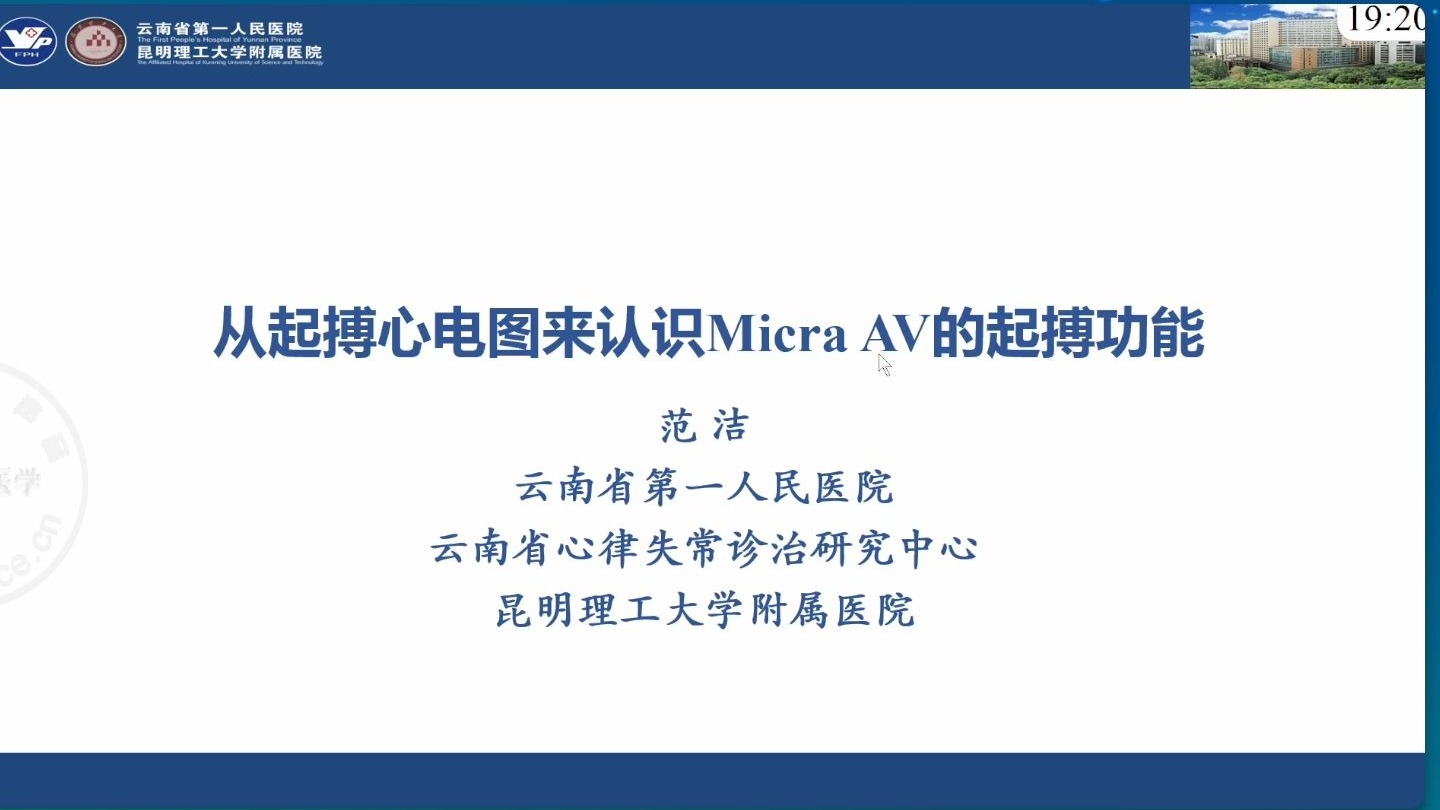 从起搏心电图来认识Micra AV的功能