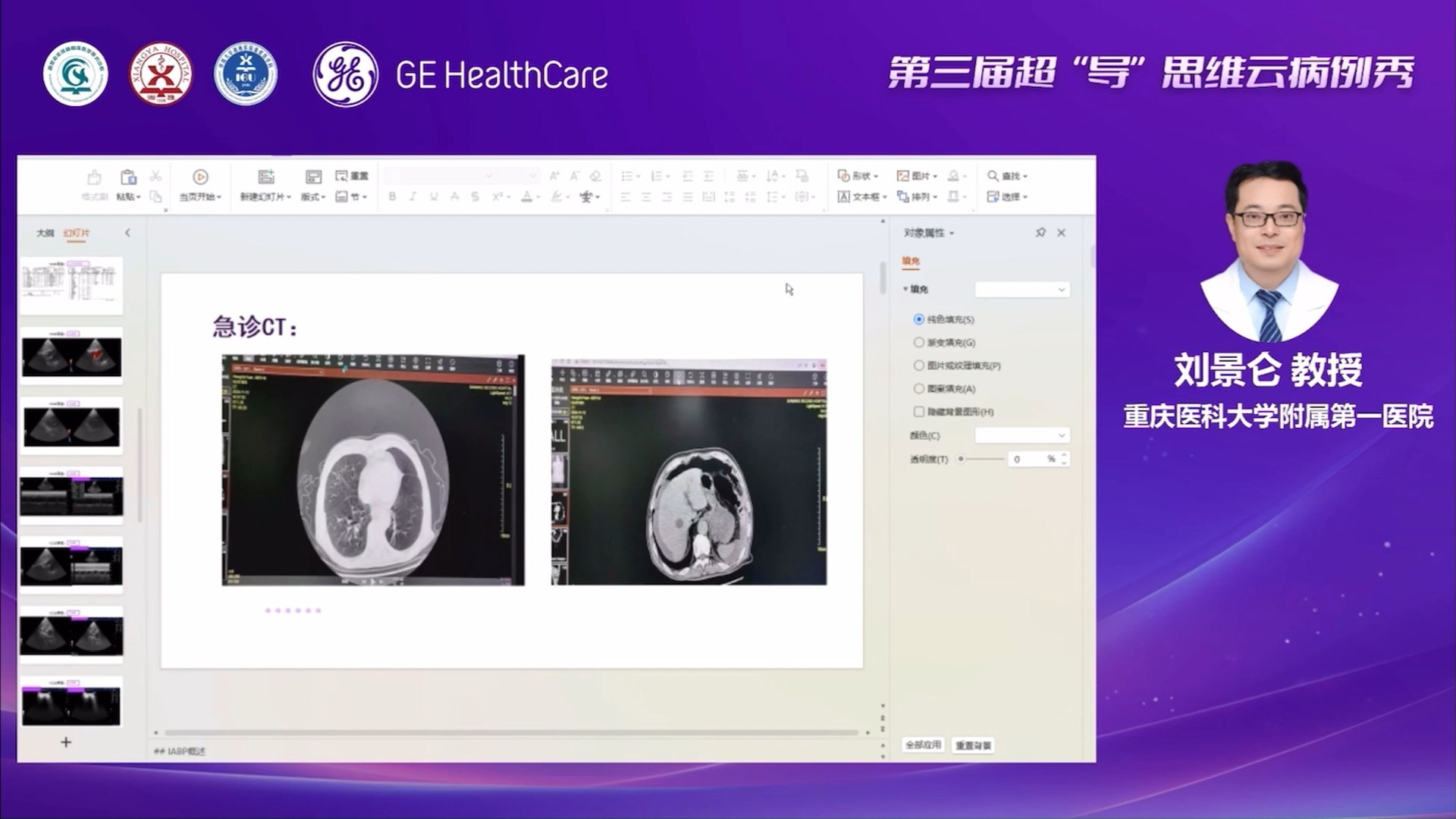 超导思维病例秀