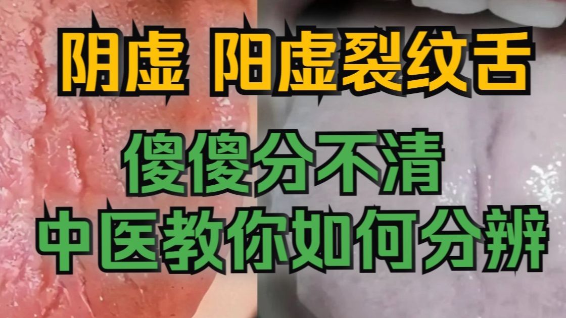 阴虚裂纹舌，阳虚裂纹舌，傻傻分不清，中医教你如何分辨!