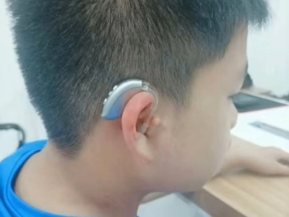 阳光开朗小帅哥的自信宣言他说：“戴助听器就像戴眼镜一样，没什