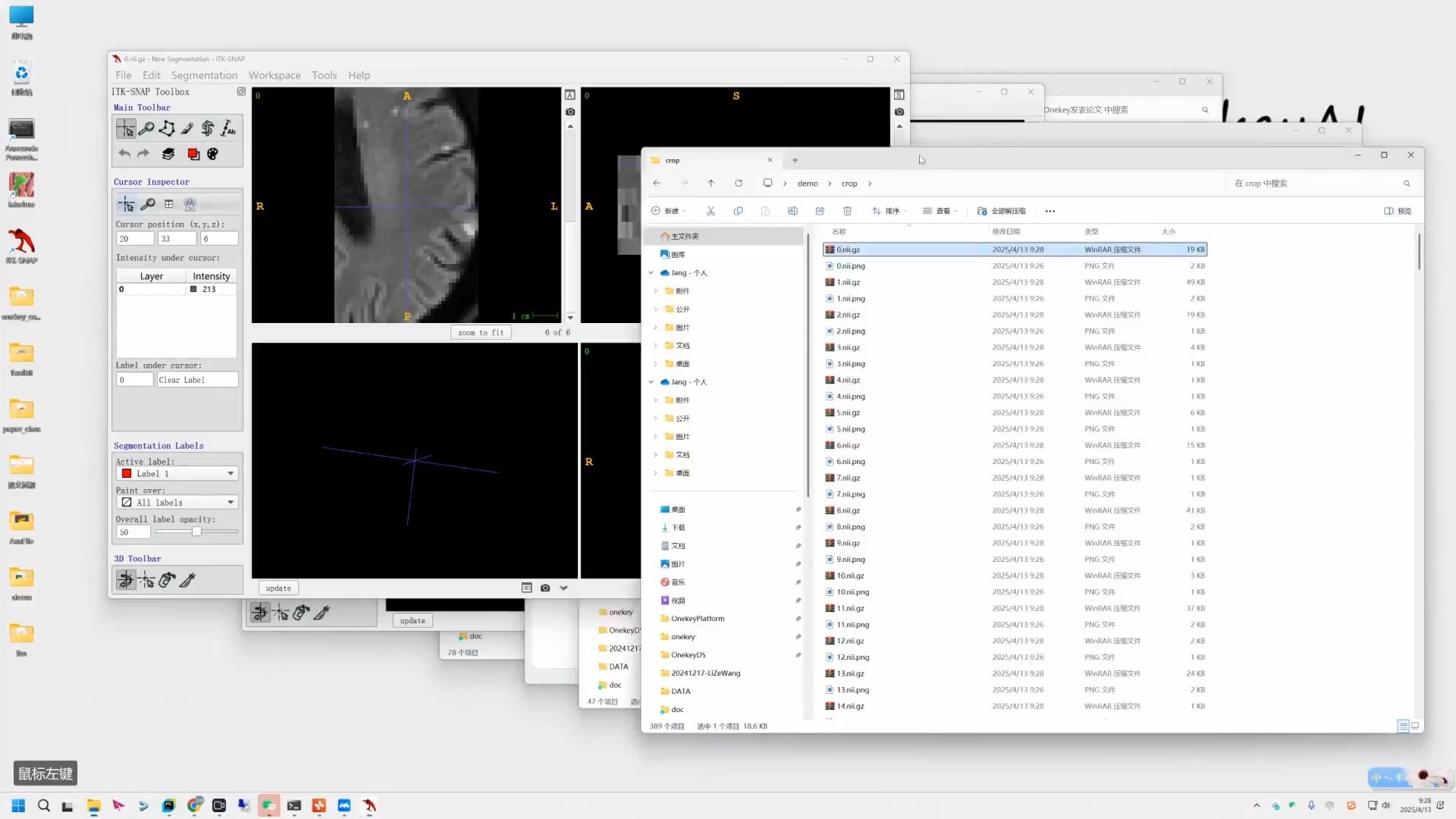 动态对比增强OCT指导的DME治疗反应预测