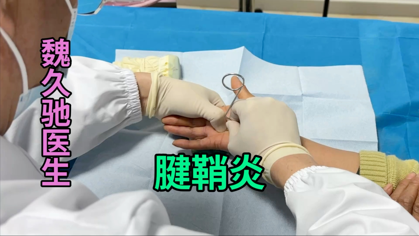微创手术快速治疗腱鞘炎