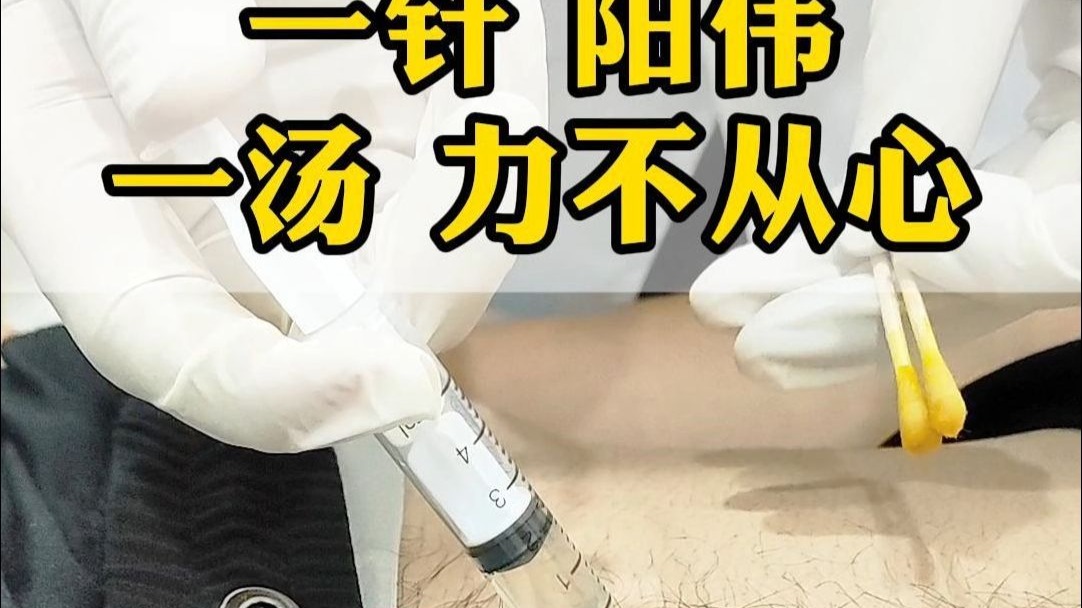 一针 阳伟 一汤 力不从心