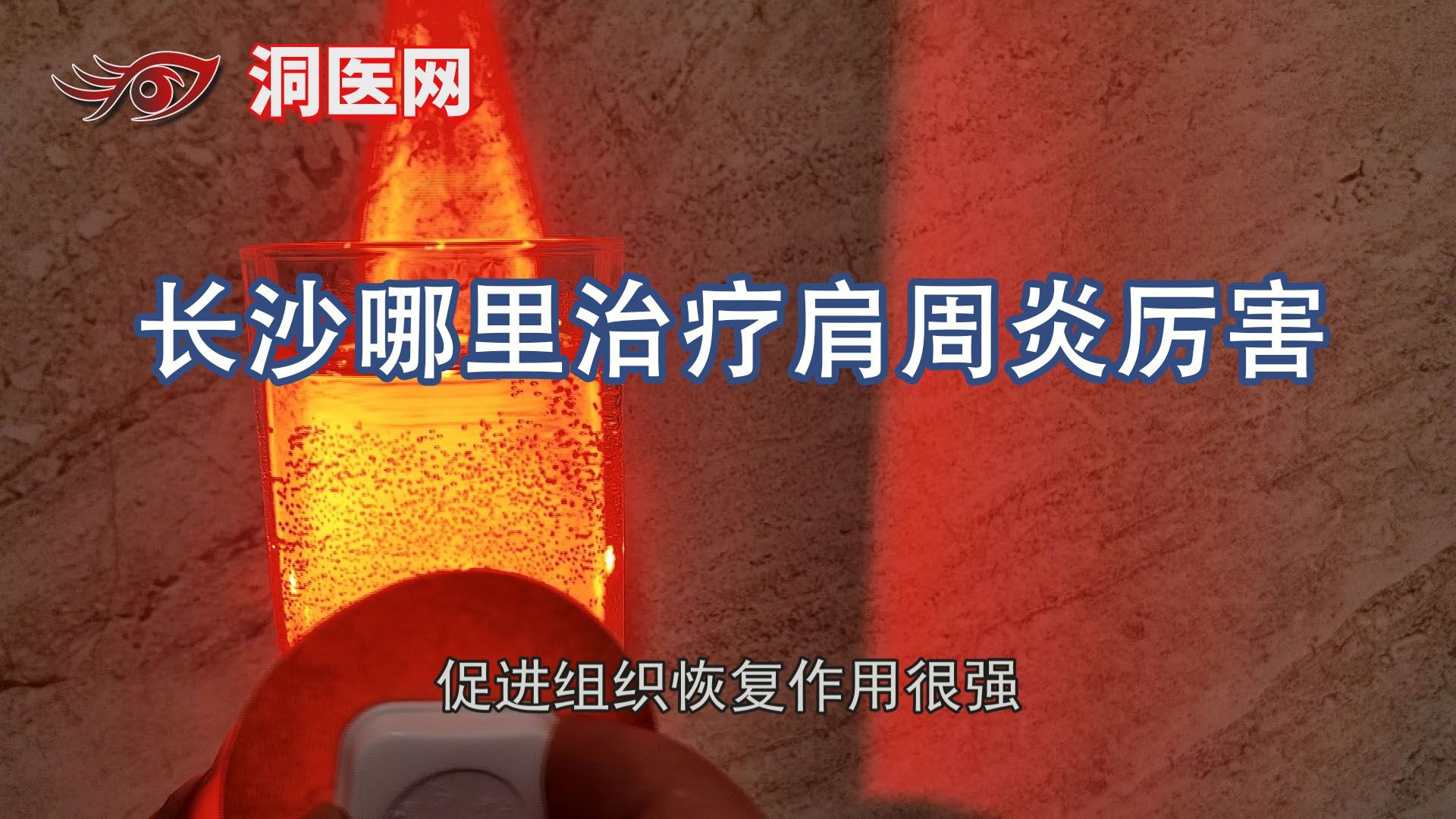 长沙哪里治疗肩周炎厉害