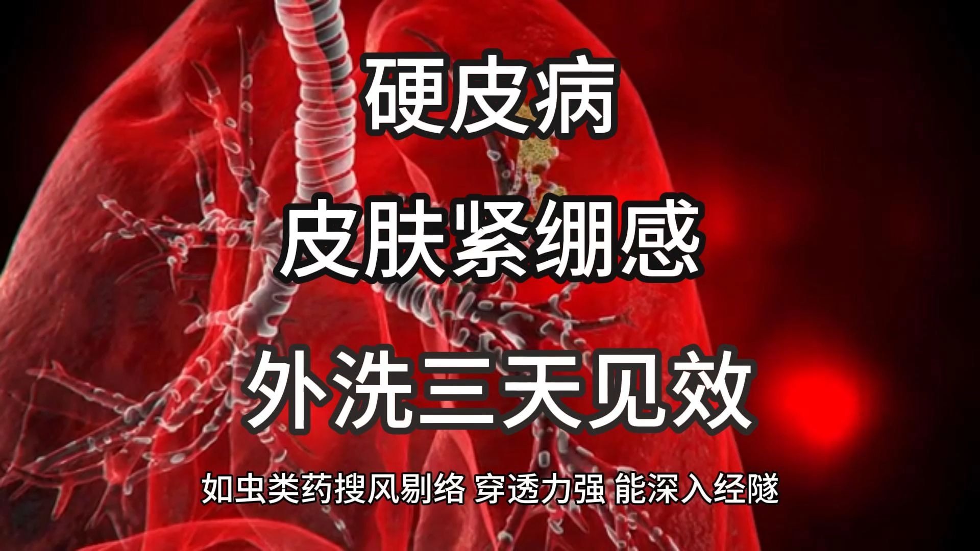 硬皮病一方改善