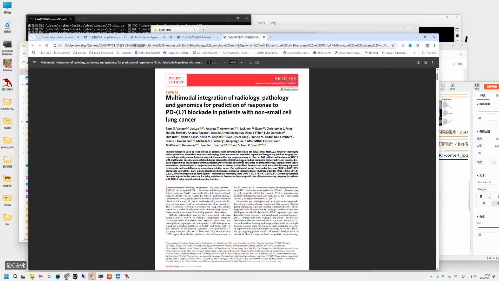 U-Net分割引导的OCT组学特征精准定位