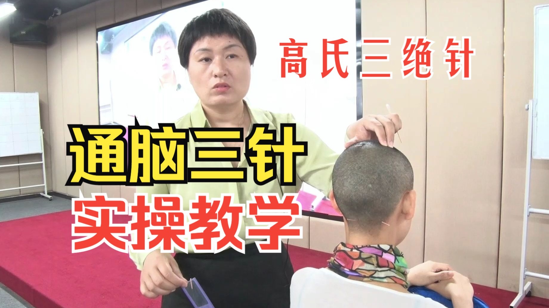 高氏三绝针：脑三针 实操教学