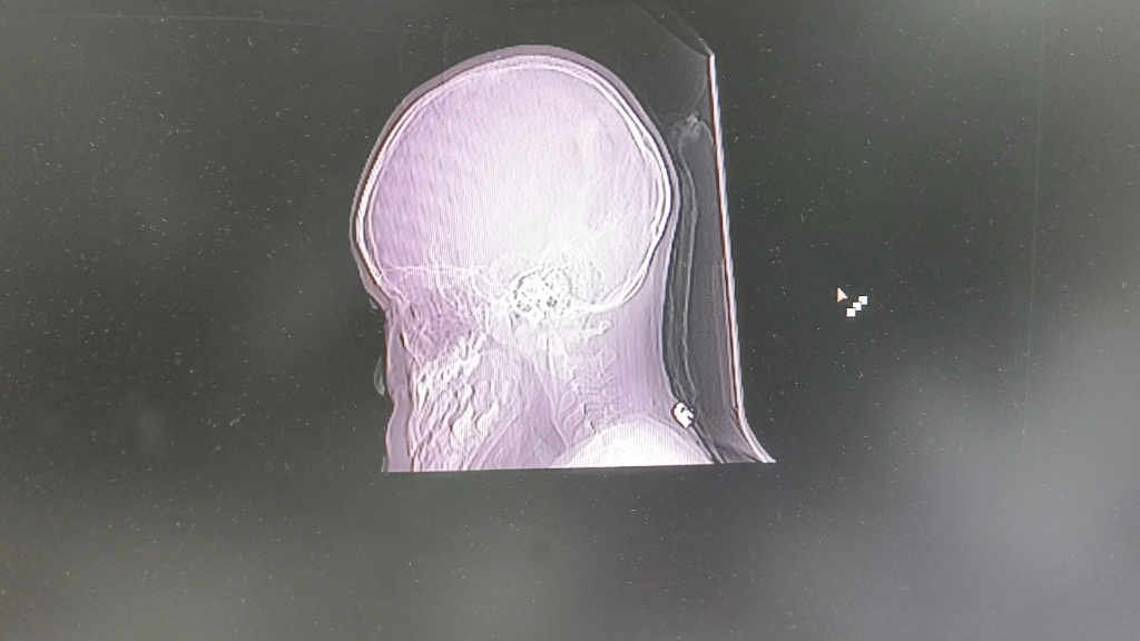 医 生，我 没 动！！！！