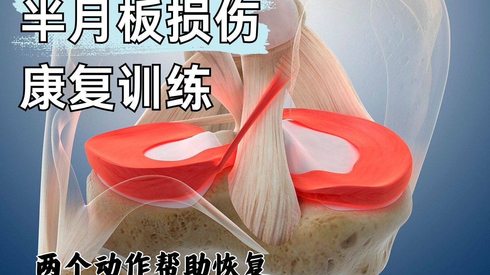 半月板损伤