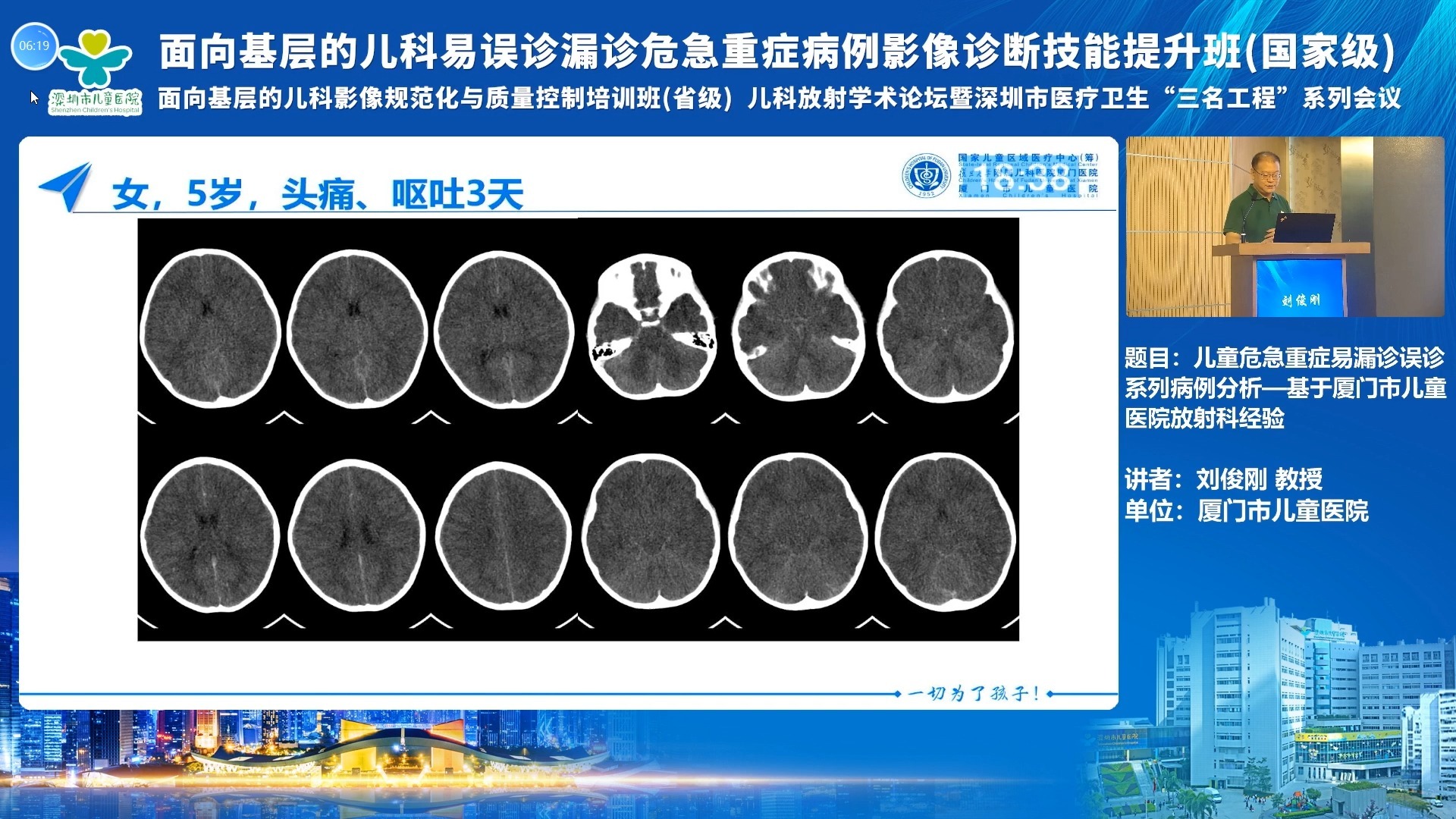 儿童危急重症易漏诊误诊系列病例分析-刘俊刚