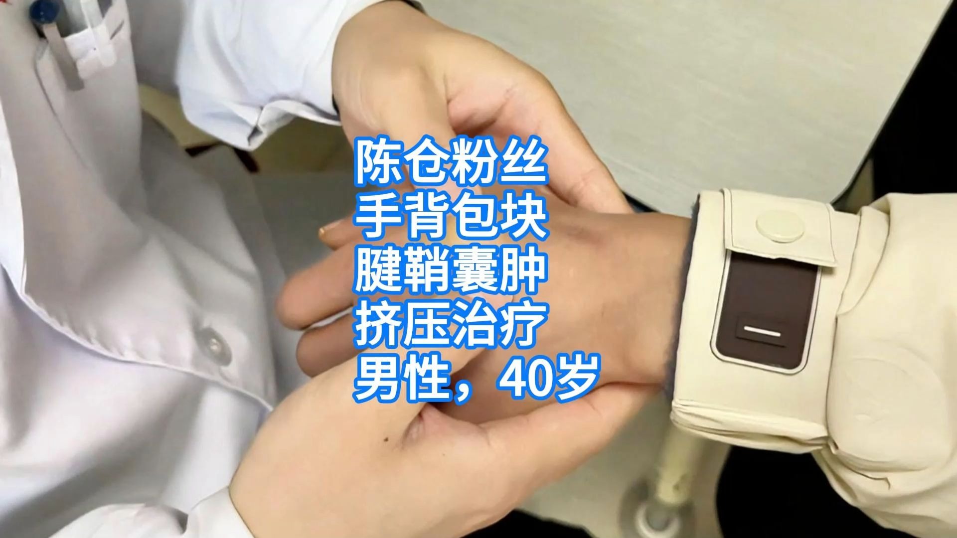 陈仓粉丝，手背包块，腱鞘囊肿，挤压治疗（男性，40岁）