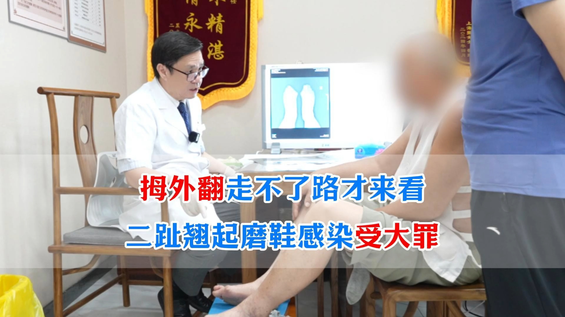 拇外翻走不了路才来看，二趾翘起磨鞋感染受大罪