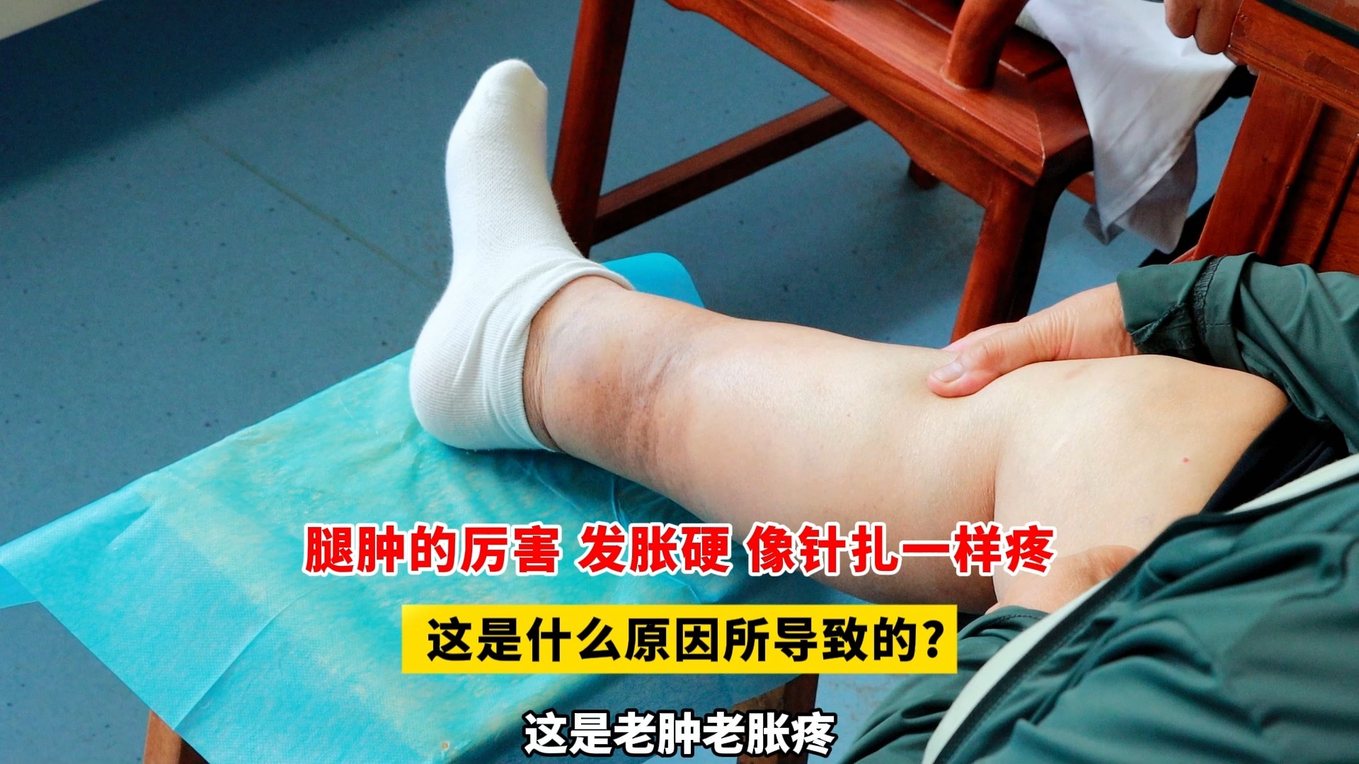 腿肿的厉害 发胀硬 像针扎一样疼，这是什么原因所导致的?