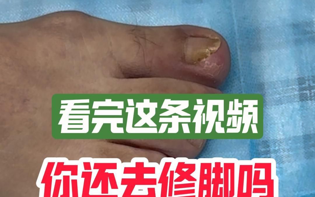 看完这条视频你还去修脚吗