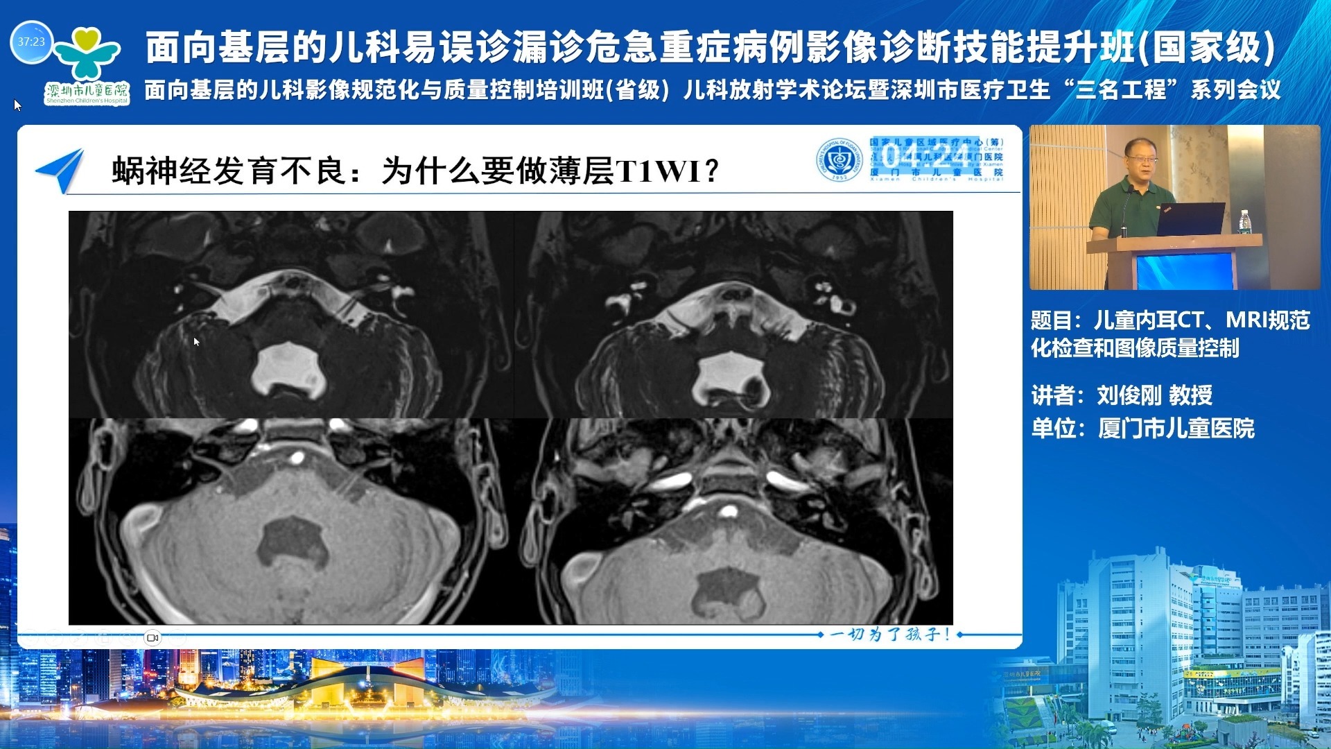 儿童内耳CT、MRI规范化检查及图像质量控制-刘俊刚