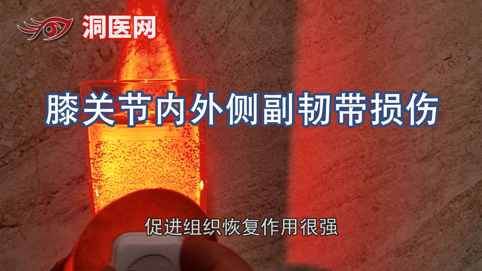 膝关节内外侧副韧带损伤