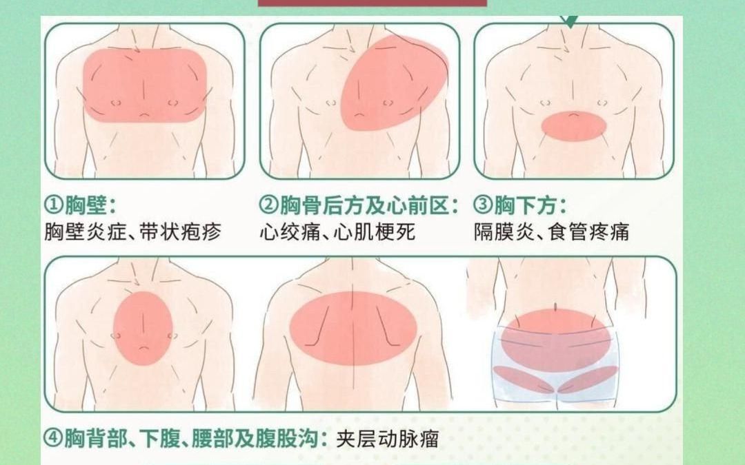 教你区分不同位置的胸痛