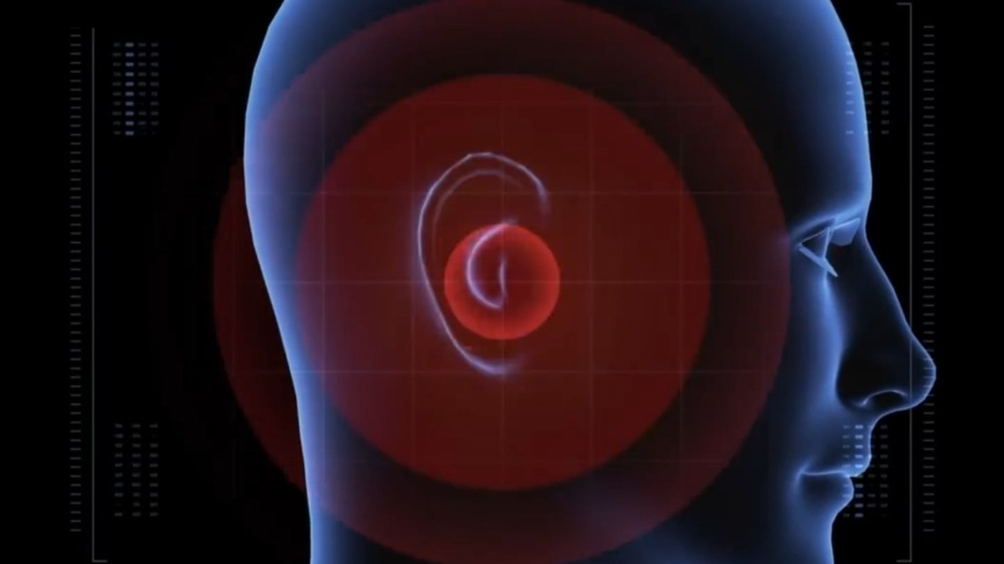 耳鸣原因大揭秘丨到底为什么会耳鸣⁉️