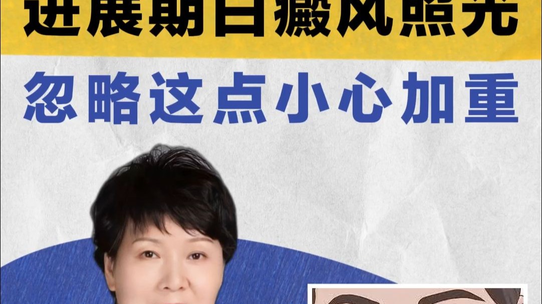 进展期白癜风照光 忽略这点小心加重