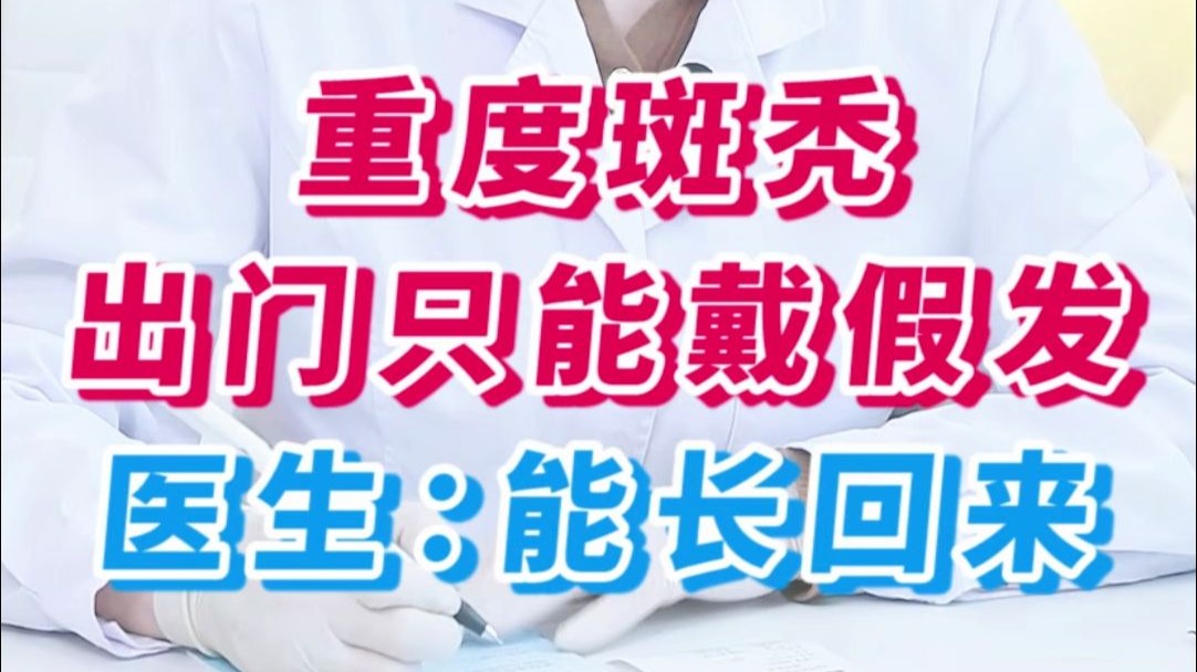 重度斑秃 出门只能戴假发 医生：能长回来