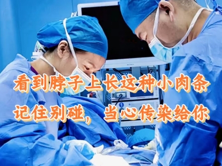 看到脖子上长这种小肉条的，记住别碰，小心传染你！